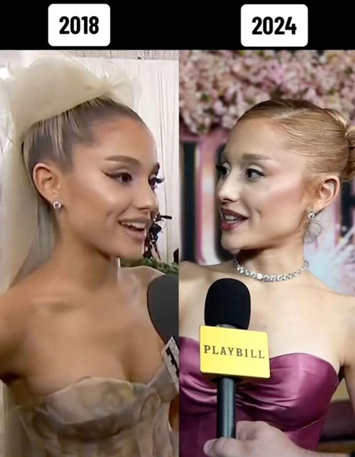 Is Ariana Grande Sick: Health Updates and Facts