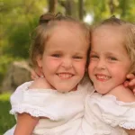 From Separation to Success: The Inspiring Journey of Siamese Twins Separated at Age 4